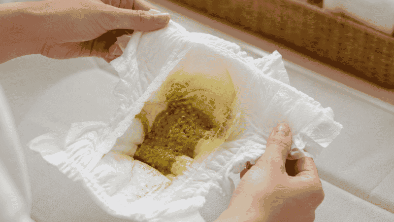 A parent examining a baby's diaper to check stool consistency for signs of constipation
