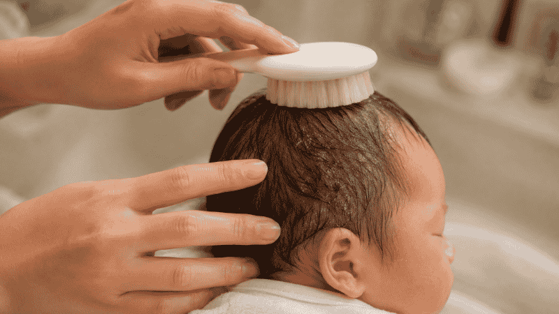 A parent using a soft baby brush to gently loosen cradle cap flakes from a newborn baby's scalp