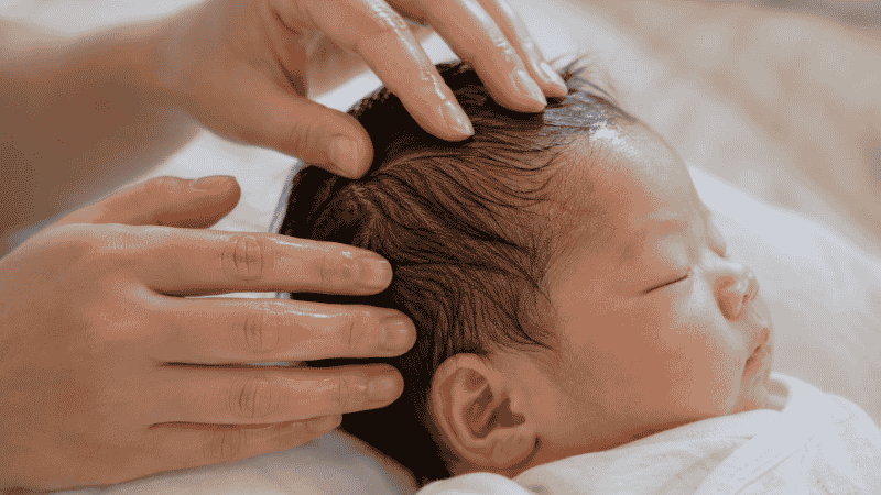 A parent applying a small amount of mineral oil to a baby's scalp to soften cradle cap scales before washing