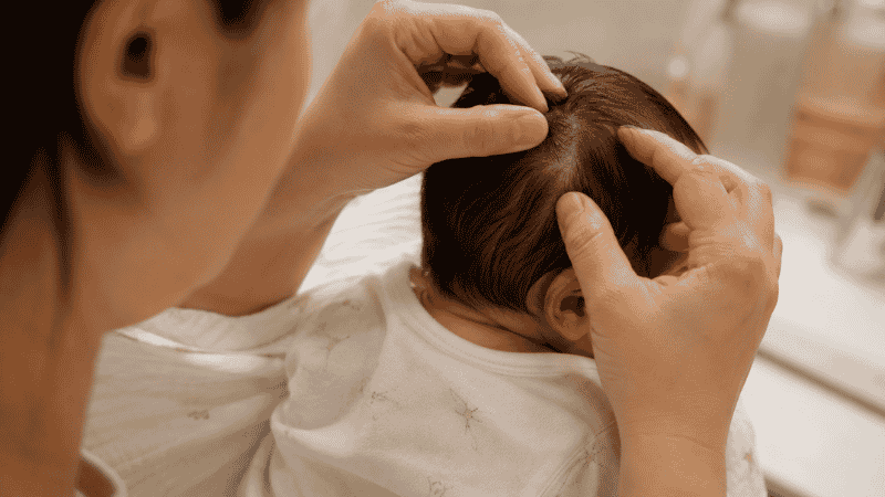 A parent gently examining their newborn baby's scalp for cradle cap patches during bath time