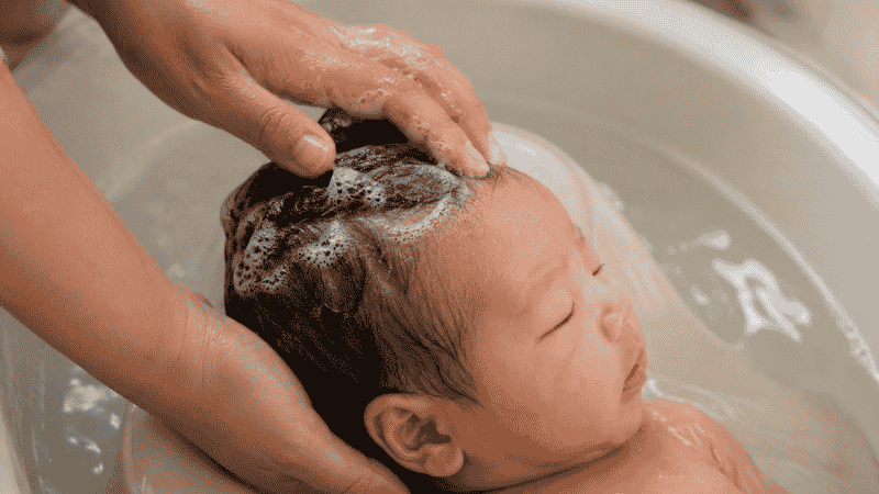 A parent washing a newborn baby's scalp with mild fragrance-free baby shampoo to remove cradle cap flakes and oil